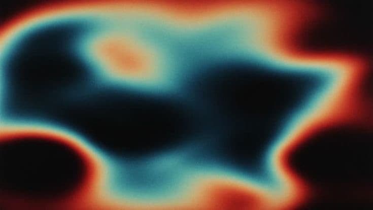 AI-Powered Stethoscope background